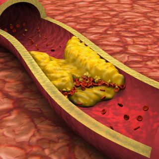 Reduce el colesterol en sangre